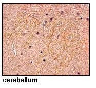 Polyclonal Rabbit anti-Human SLC4A10 Antibody (IHC)