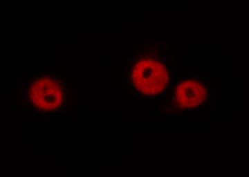 LMNA / Lamin A+C Antibody