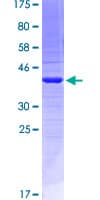 Human EMILIN2 Protein (Recombinant GST, N-terminus)