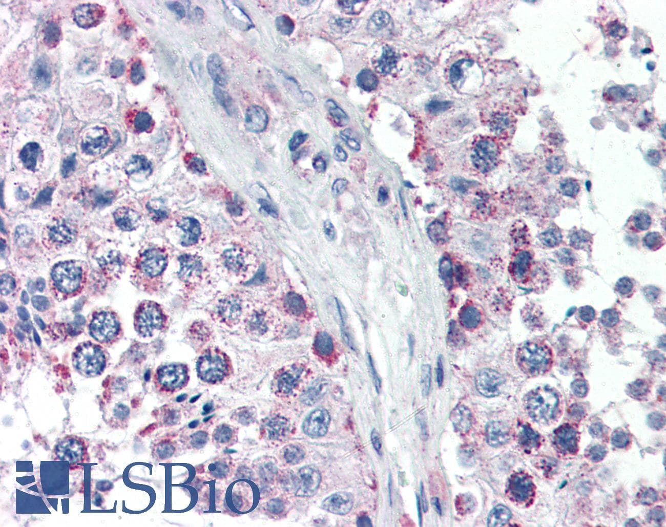 IHC-plus™ GPSM2 / LGN Antibody (aa448-462)