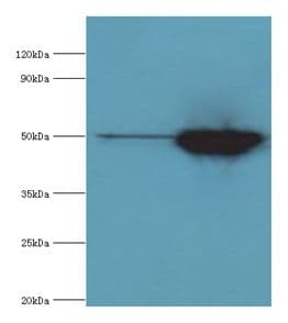 Polyclonal Rabbit anti-Human IDH2 Antibody (aa193-452, WB)