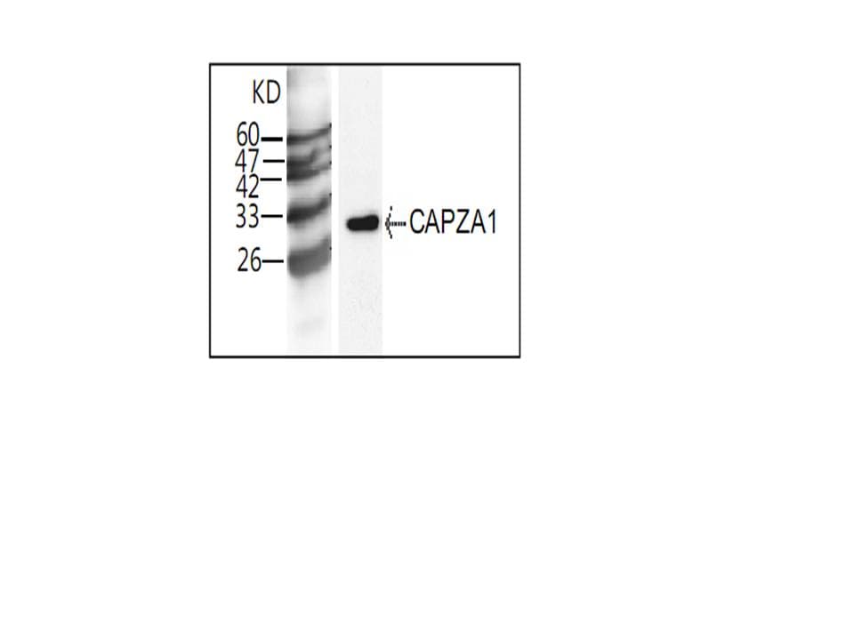 IHC-plus™ CAPZA1 / CAPZ Alpha 1 Antibody