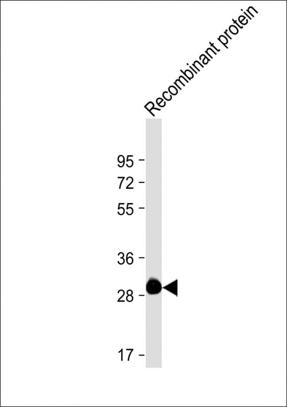 ROS1 / ROS Antibody (clone 1843CT776.78.21)