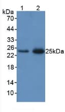 LCN2 / Lipocalin 2 / NGAL Antibody (aa21-198)