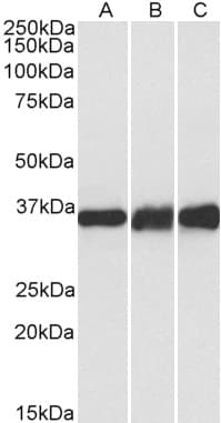 IHC-plus™ LDHB / Lactate Dehydrogenase B Antibody (aa297-310)