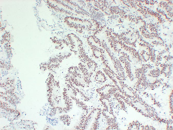 Monoclonal Mouse anti-Human MLH1 Antibody (clone ABT-MLH1, IHC, WB)
