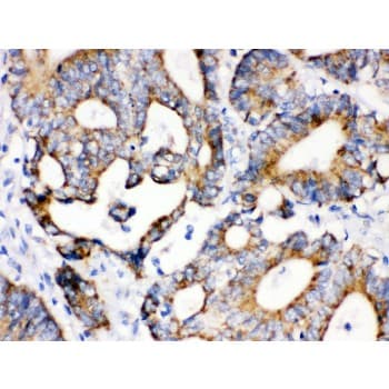 IDH2 Antibody (aa413-447)