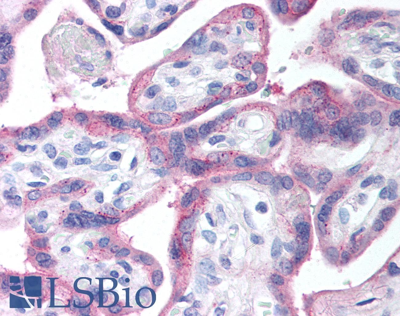 IHC-plus™ Polyclonal Rabbit anti-Human EGFR Antibody (aa1175-1200, IHC, WB)