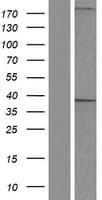 AKR1D1 Protein (Over-Expression Lysate Myc-DDK (Flag))