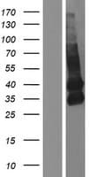 TMEM119 Protein (Over-Expression Lysate Myc-DDK (Flag))