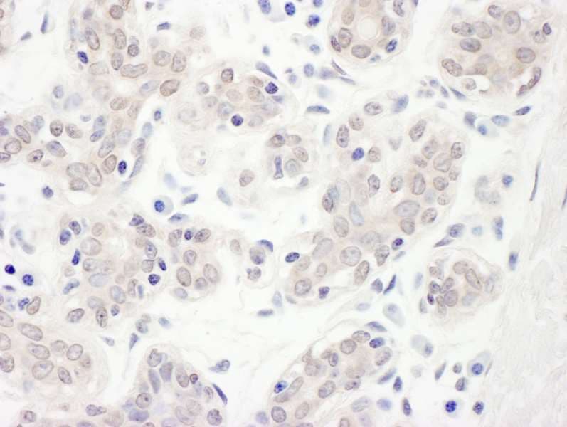 Polyclonal Rabbit anti-Human CBLL1 / HAKAI Antibody (aa1-50, IHC)