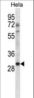 Polyclonal Rabbit anti-Human NHEJ1 / XLF Antibody (aa268-296, WB)