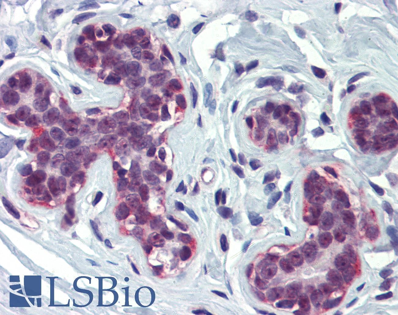 Polyclonal Rabbit anti-Human CREBBP / CREB Binding Protein Antibody (aa144-193, IHC, WB)