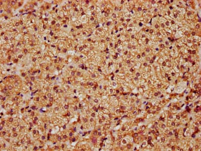 Polyclonal Rabbit anti-Human LATS1 Antibody (IHC, IF)