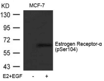 Polyclonal Rabbit anti-Human ER Alpha / Estrogen Receptor Antibody (IHC, WB)