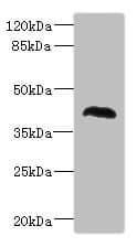 MALIN / NHLRC1 Antibody