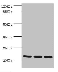 Polyclonal Rabbit anti-Human TAGLN2 / Transgelin 2 Antibody (IHC, WB)