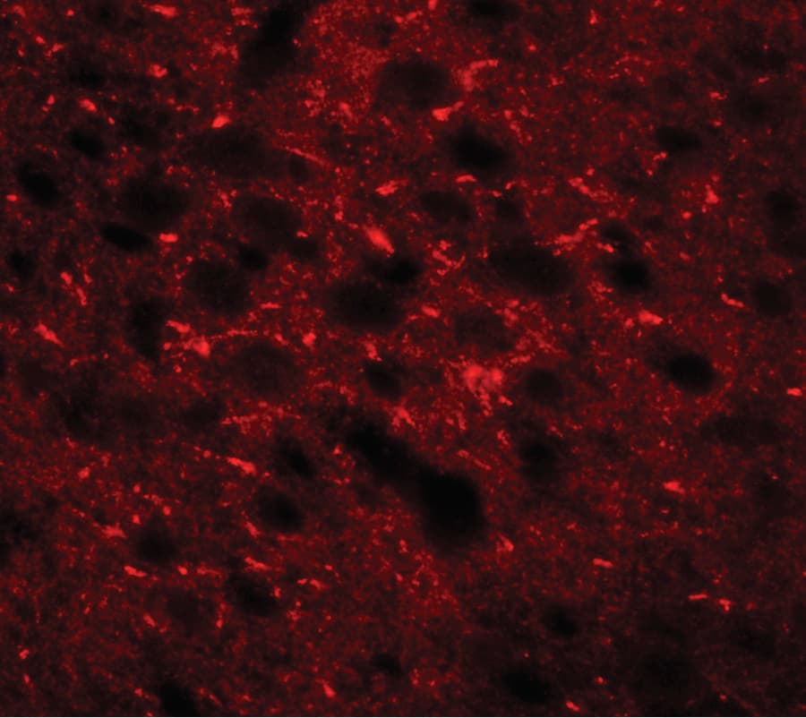 TMEM88 Antibody