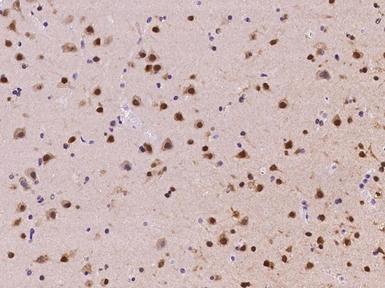 NOVA1 Antibody