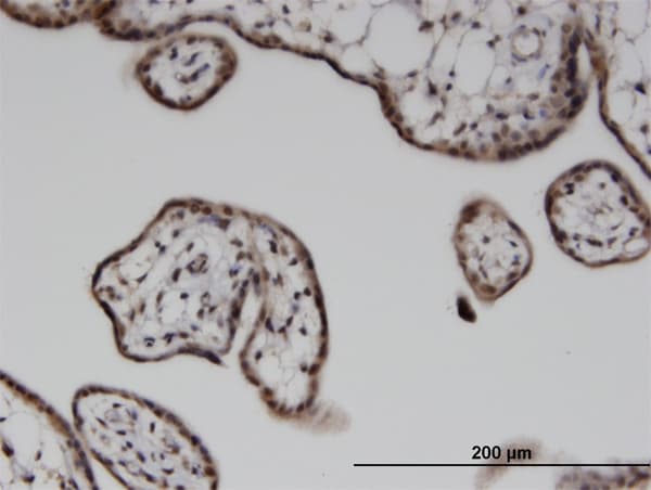 ILKAP Antibody (clone 3B5)