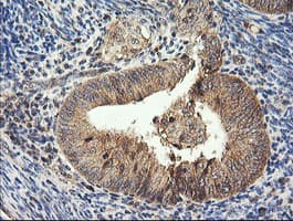 HRAS / H-Ras Antibody (clone OTI1D9)