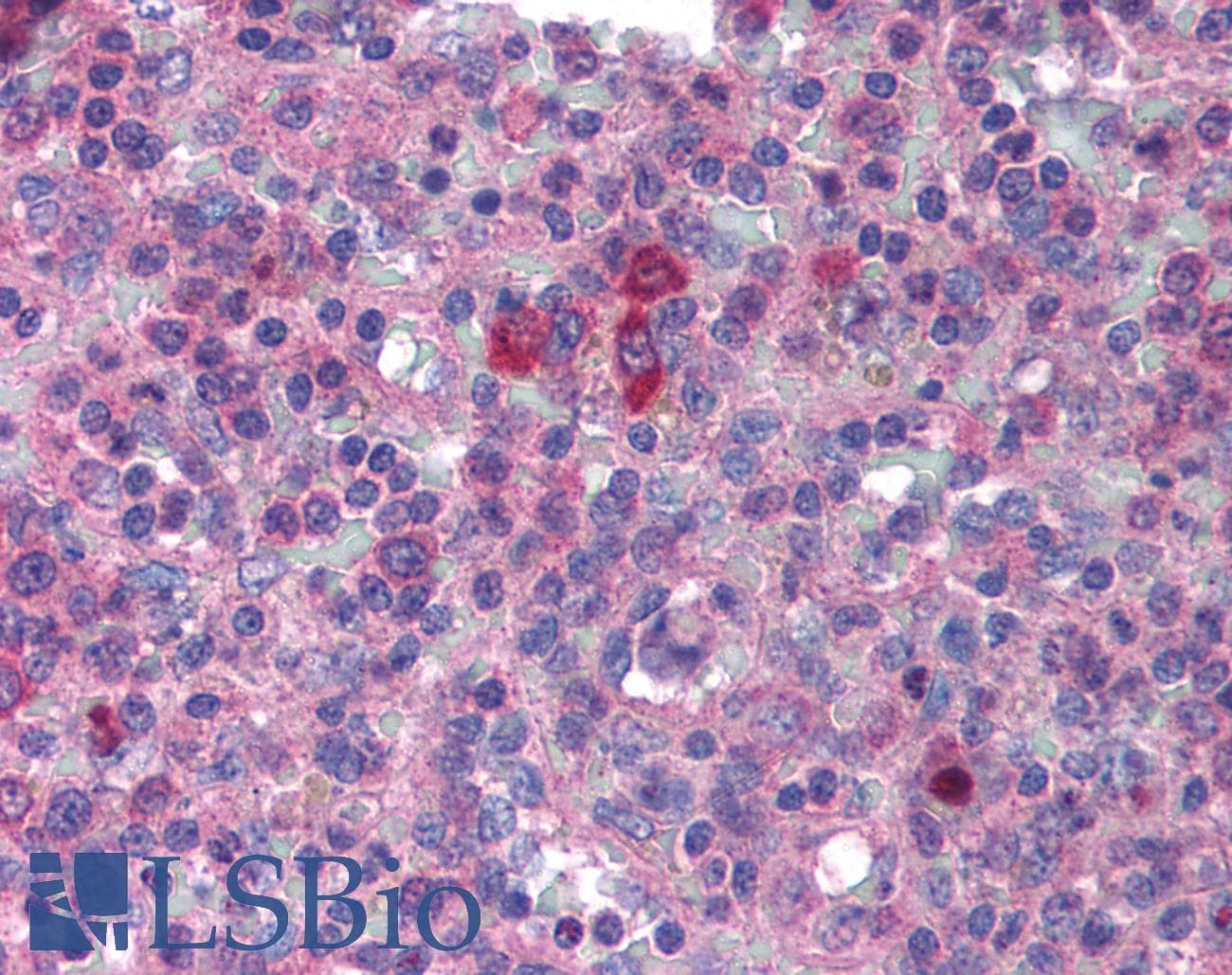 IHC-plus™ Polyclonal Rabbit anti-Human MYD88 Antibody (IHC, IF, WB)