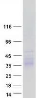 Human CD244 Protein (Recombinant Myc-DDK (Flag))