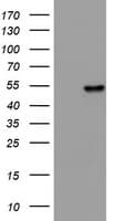 KRT20 / CK20 / Cytokeratin 20 Antibody (clone OTI11A1)