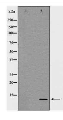 Polyclonal Rabbit anti-Human S100A4 / FSP1 Antibody (WB)