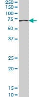 Monoclonal Mouse anti-Human ACADVL Antibody (clone 5D3, IHC, WB)