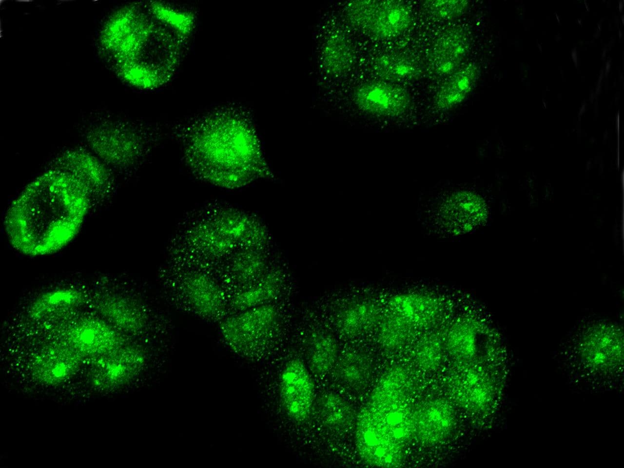 ESR2 / ER Beta Antibody (Preservative Free)