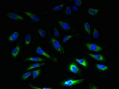 IHC-plus™ Polyclonal Rabbit anti-Human SLC1A6 / EAAT4 Antibody (IHC, WB)