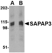 DLGAP3 / SAPAP3 Antibody