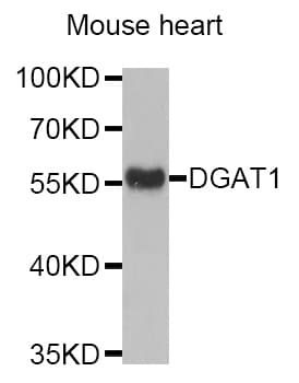 Polyclonal Rabbit anti-Human DGAT1 Antibody (aa200-300, WB)