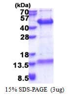 Human FAM84B Protein (Recombinant His)