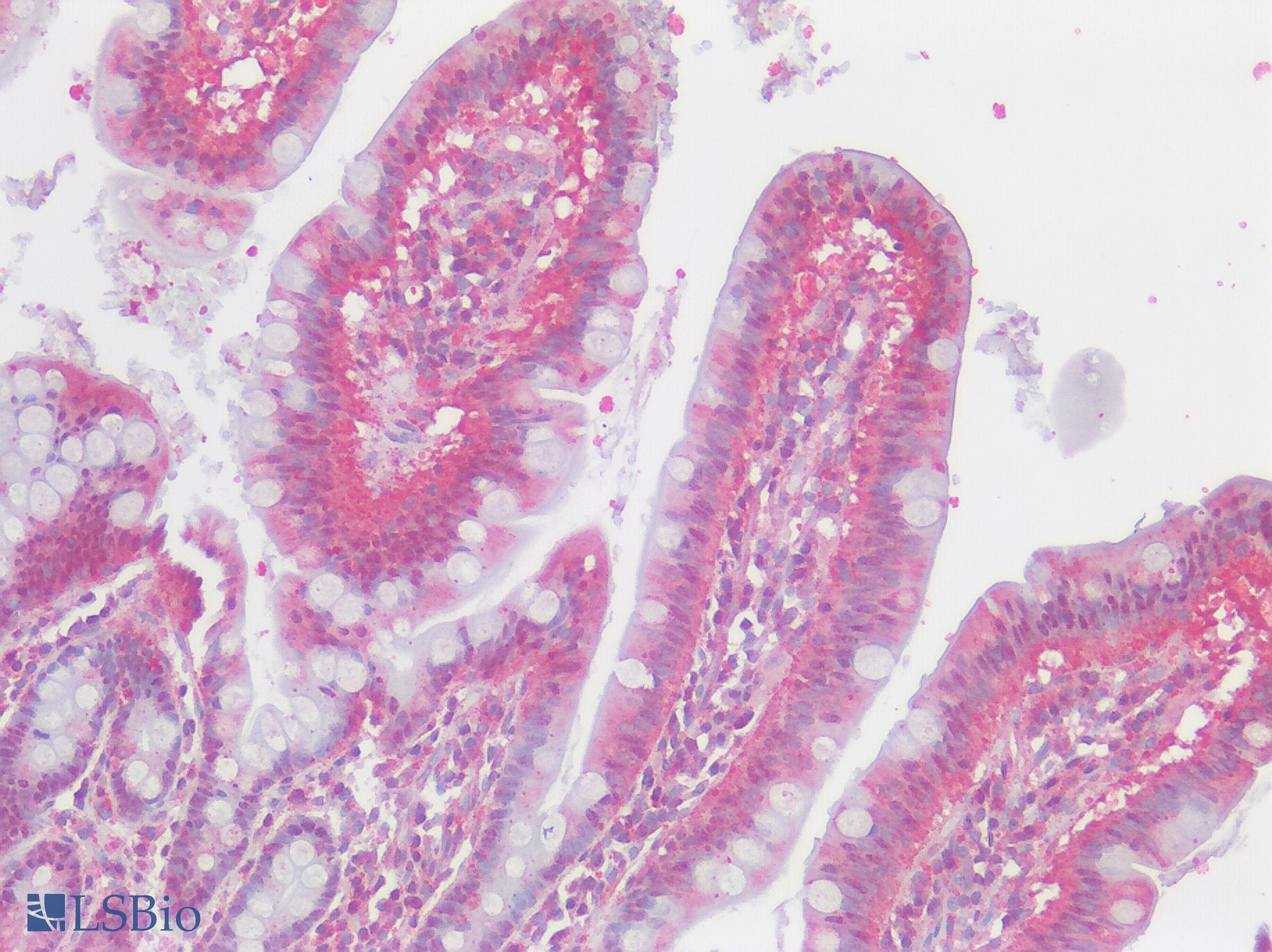 IHC-plus™ ADORA3 / Adenosine A3 Receptor Antibody (Cytoplasmic Domain)