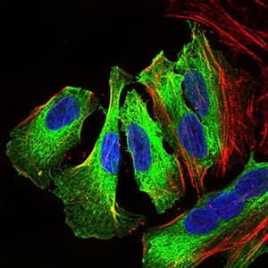 Monoclonal Mouse anti-Human MAPK14 / p38 Antibody (clone 8G4D11, aa299-360, IHC, IF, WB)