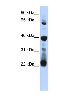 Polyclonal Rabbit anti-Human RPUSD3 Antibody (aa251-300, WB)