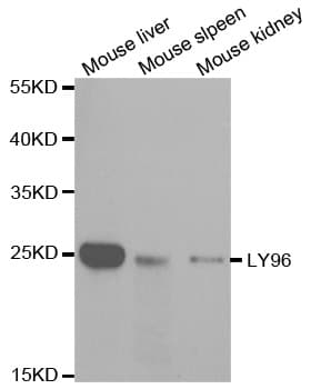 IHC-plus™ LY96 / MD2 / MD-2 Antibody