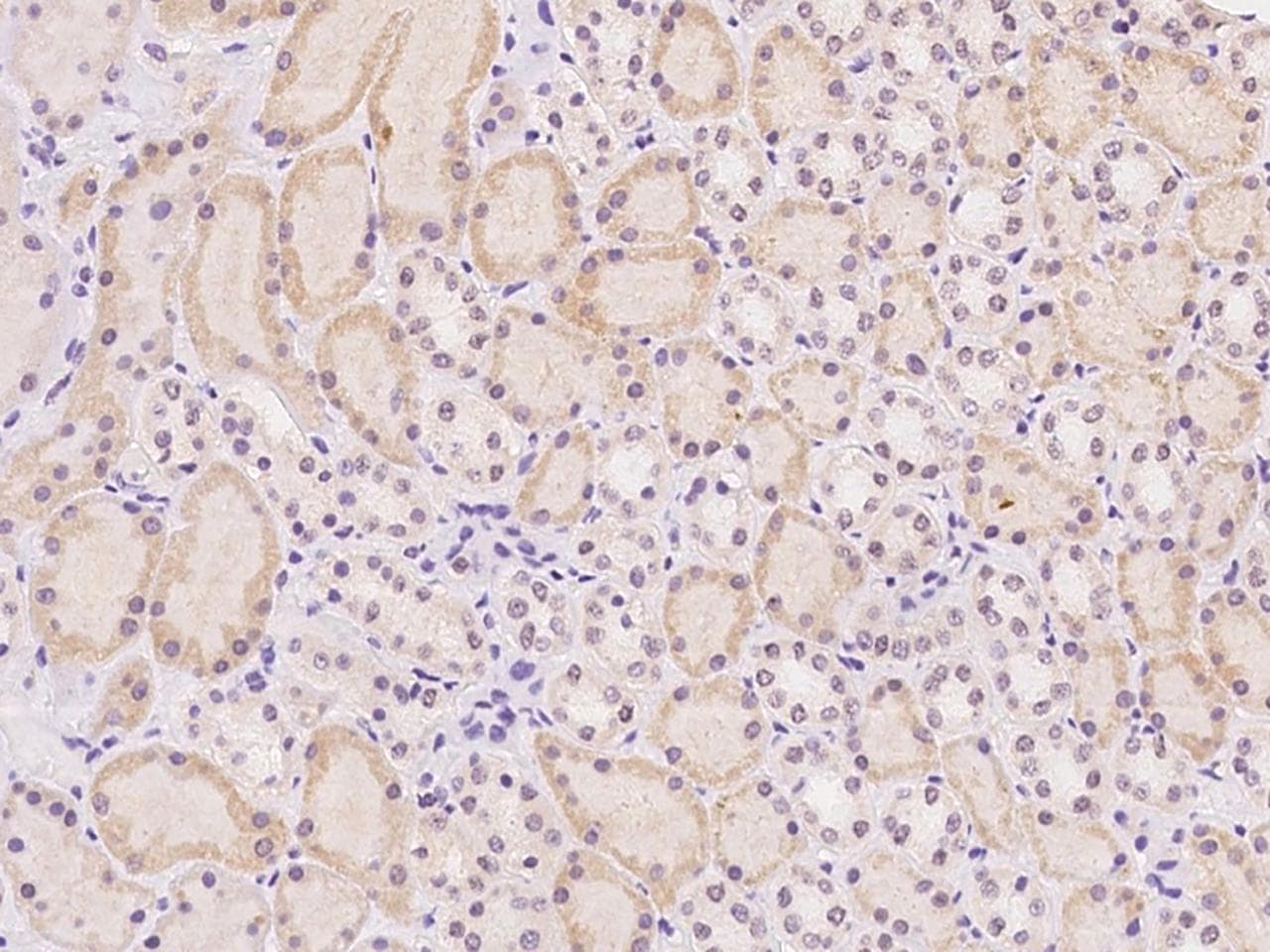 Polyclonal Rabbit anti-Human HIWI2 / PIWIL4 Antibody (IHC)