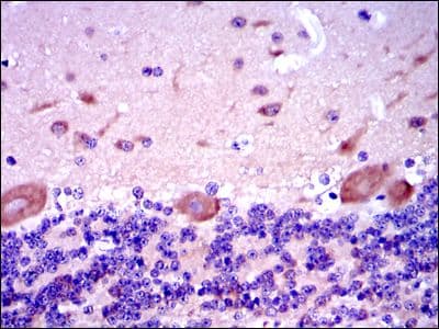 SMAD2 Antibody (clone 5G7)