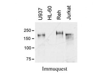 MER / MERTK Antibody (Extracellular Domain, clone A311F9G3)