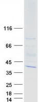 Human WDR83 Protein (Recombinant Myc-DDK (Flag))