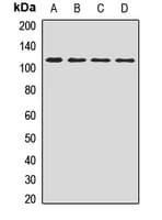 PKD2 / Polycystin 2 Antibody