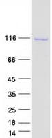 Human ITIH3 Protein (Recombinant Myc-DDK (Flag))