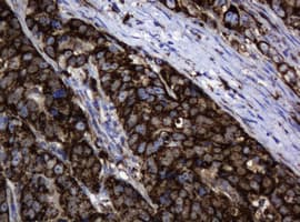 PathPlus™ HSPD1 / HSP60 Antibody (clone OTI3A2)
