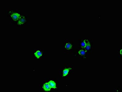 MAP3K8 / TPL2 Antibody