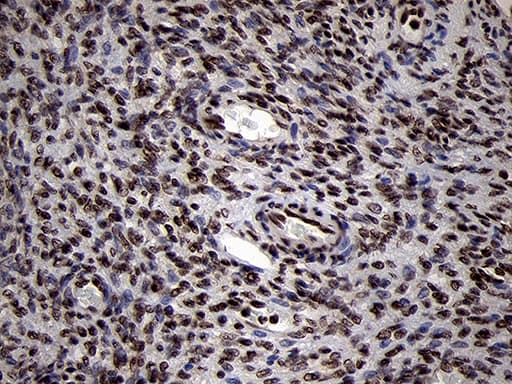 SMC1A / SMC1 Antibody (aa889-1016, clone OTI3G4, Carrier-free)