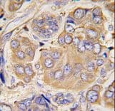 HSPB1 / HSP27 Antibody (Ser78)