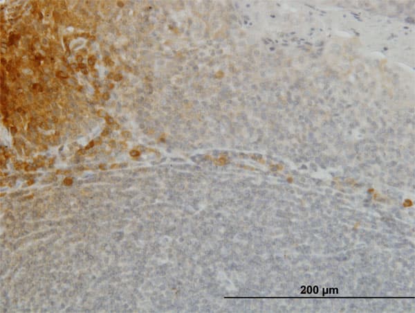 FGF21 Antibody (clone 2F11)